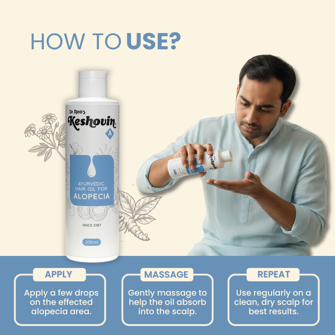 Reduce Bald Patches, Beard Hair Loss & Control Hair Thinning – Keshovin-A Ayurvedic Hair Oil for Alopecia