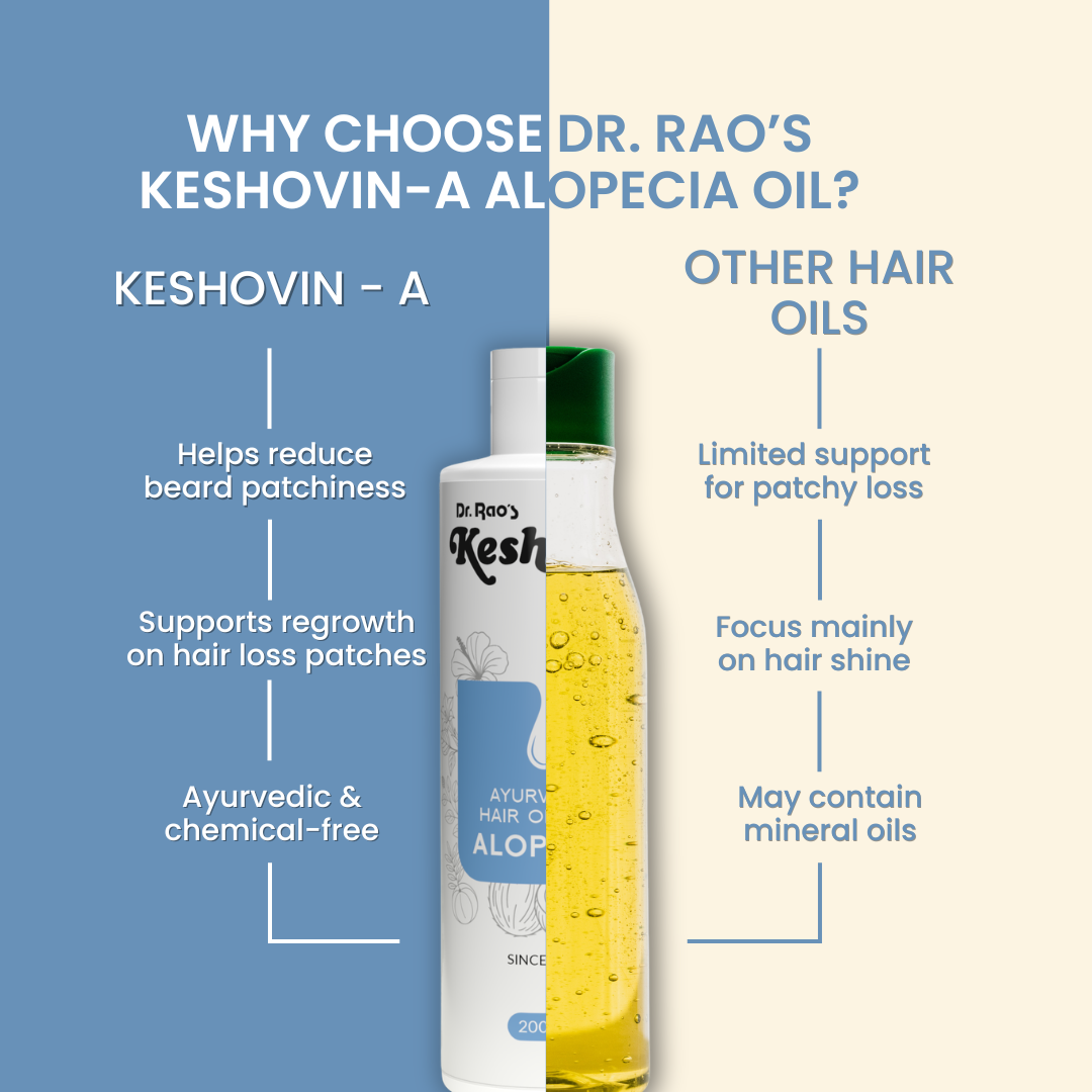 Reduce Bald Patches, Beard Hair Loss & Control Hair Thinning – Keshovin-A Ayurvedic Hair Oil for Alopecia